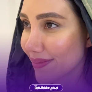 نمونه کار عمل دکتر حمیدرضا مفرد 2