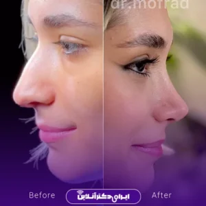 نمونه کار عمل دکتر حمیدرضا مفرد 5
