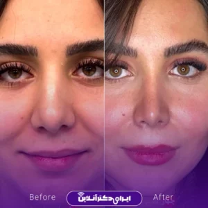 نمونه کار عمل دکتر حمیدرضا مفرد 8