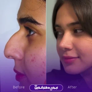 نمونه کار عمل دکتر حمیدرضا مفرد 9