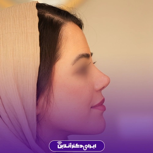 بهترین جراح بینی گوشتی در تهران + معرفی 20 پزشک برتر 95 نمونه کار عمل بینی گوشتی دکتر لیلا ملکی 2