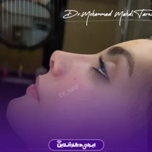 نمونه کار عمل بینی دکتر محمد مهدی طرزی 10