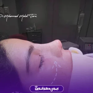 نمونه کار عمل بینی دکتر محمد مهدی طرزی 2