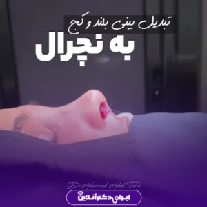 نمونه کار عمل بینی دکتر محمد مهدی طرزی 4