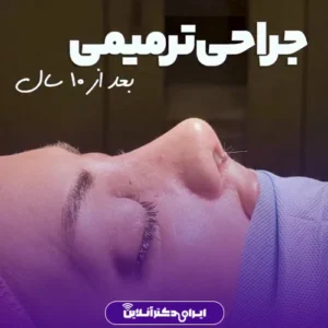 نمونه کار عمل بینی دکتر محمد مهدی طرزی 6