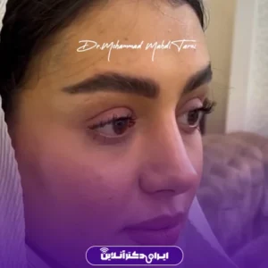 نمونه کار عمل بینی دکتر محمد مهدی طرزی 7