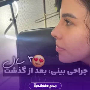 نمونه کار عمل بینی دکتر محمد مهدی طرزی 8