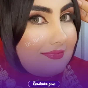 نمونه کار عمل بینی دکتر محمد مهدی طرزی 9