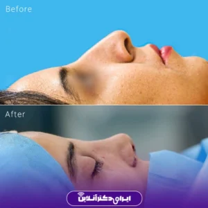 نمونه کار عمل بینی دکتر نجمه برخورداری 4