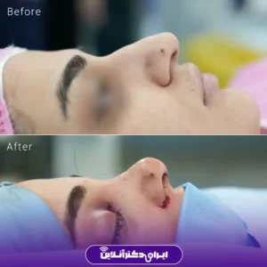 نمونه کار عمل بینی دکتر نجمه برخورداری 8