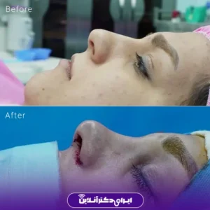 نمونه کار عمل بینی دکتر نجمه برخورداری 9