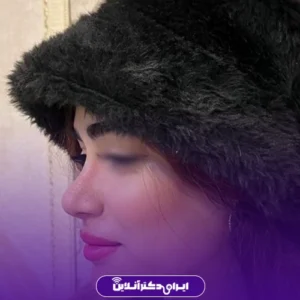 نمونه کار نیم‌رخ جراحی بینی گوشتی خانم‌ها دکتر منصور توفیقی زواره در شهر کرج