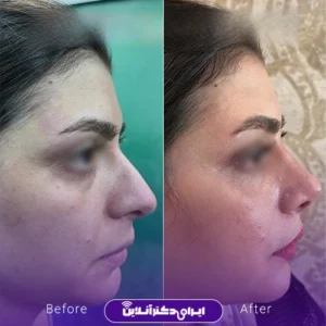 نمونه عمل دکتر منصور توفیقی زواره4
