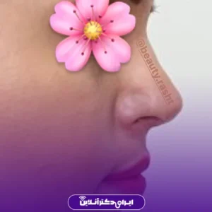 نمونه عمل جراحی دکتر سعید فلاحتی 1
