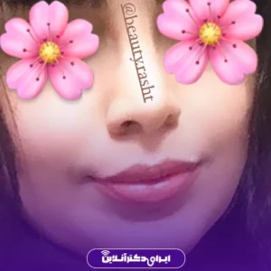 نمونه عمل جراحی دکتر سعید فلاحتی 2