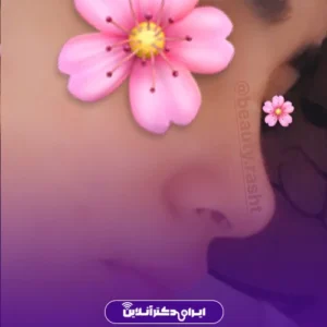 نمونه عمل جراحی دکتر سعید فلاحتی 3