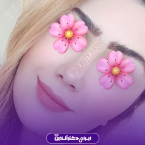 نمونه عمل جراحی دکتر سعید فلاحتی 5