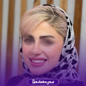 نمونه عمل بینی دکتر شهاب خسروی 8