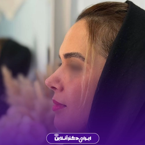 بهترین جراح بینی گوشتی در تهران + معرفی 20 پزشک برتر 67 نمونه جراحی بینی گوشتی دکتر یوسف شفایی 2