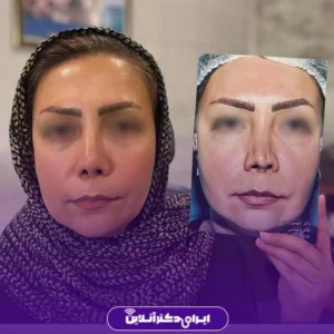 نمونه عمل انجام شده دکتر شایسته شهمیرزادی2