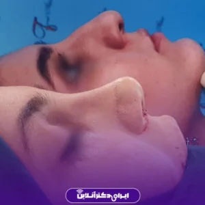نمونه جراحی های عمل دکتر فرید عطار 2