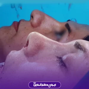 نمونه جراحی های عمل دکتر فرید عطار 3