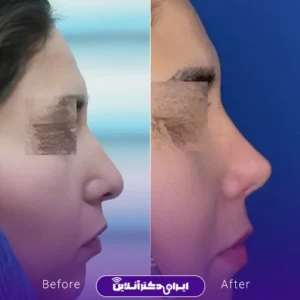 نمونه کار عمل بینی دکتر حسن هنرور اسدالهی 6