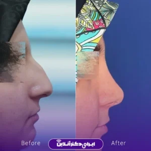 نمونه کار عمل بینی دکتر حسن هنرور اسدالهی 7