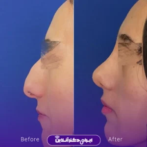نمونه کار عمل بینی دکتر حسن هنرور اسدالهی 9