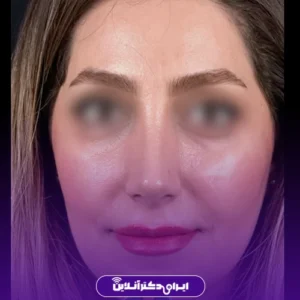 نمونه کار عمل بینی دکتر احمدرضا رجایی 7