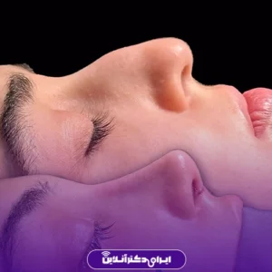 نمونه کار عمل بینی دکتر احمدرضا رجایی 9