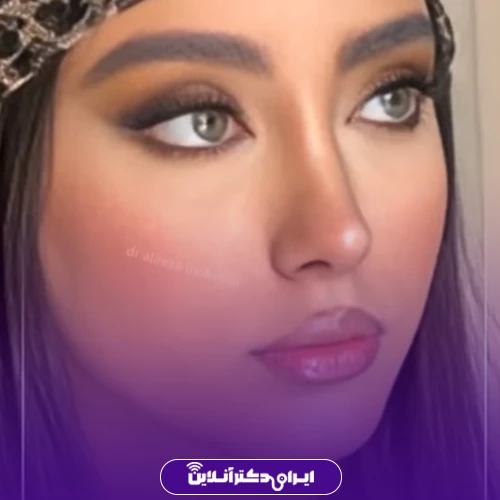 بهترین جراح بینی استخوانی در تهران + لیست 8 پزشک متخصص 109 نمونه کار عمل بینی دکتر علیرضا محبی 9