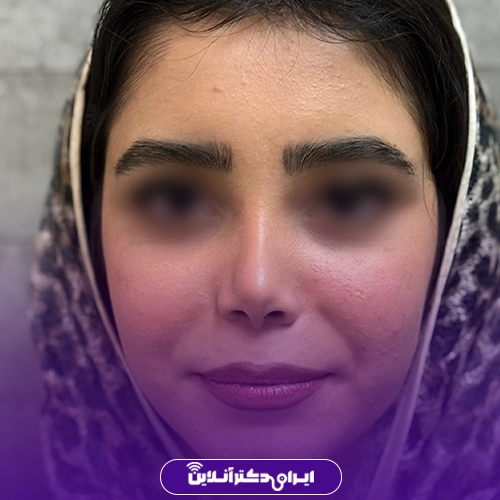 بهترین جراح بینی در کرج + نمونه کار و هزینه 1405 141 جراحی های بینی موفق توسط دکتر ماریا اندجی گرمارودی 2
