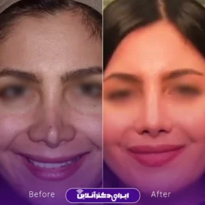 نمونه کار دکتر روزینا بشارتی زاده - 2