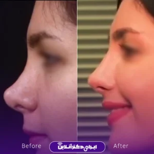 نمونه کار دکتر روزینا بشارتی زاده - 3