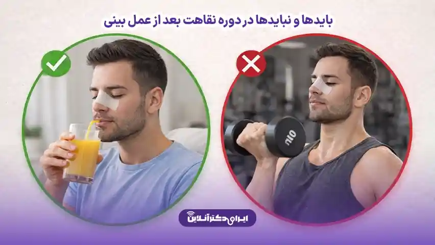 صفر تا صد دوره نقاهت عمل بینی + رازهای بهبودی سریع و کاهش ورم 8 بایدها و نبایدها در دوره نقاهت بعد از عمل بینی