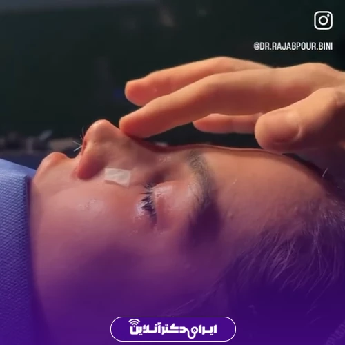 بهترین جراح بینی در تهران + لیست 18 مورد از بهترین جراحان 192 نمونه کار عمل بینی دکتر احمدعلی رجب پور 2