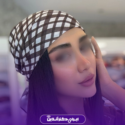 بهترین دکتر پولیپ بینی در اصفهان + لیست 10 جراح متخصص برتر 48 نمونه کار عمل بینی دکتر امین قانعی 2