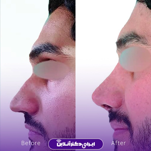 بهترین دکتر پولیپ بینی در اصفهان + لیست 10 جراح متخصص برتر 54 دکتر فرزانه ابوطالبیان الیادرانی 4