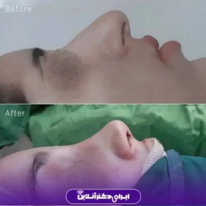 نمونه کار عمل بینی دکتر حسین محمودی 5