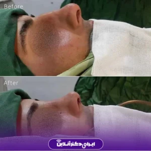 نمونه کار عمل بینی دکتر حسین محمودی 2
