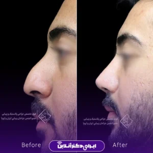 نمونه کار عمل بینی دکتر جلال معتمدی فر 2