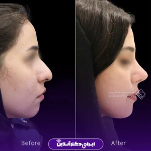 نمونه کار عمل بینی دکتر جلال معتمدی فر 6