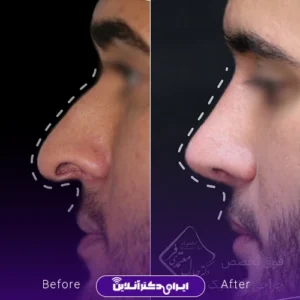 نمونه کار عمل بینی دکتر جلال معتمدی فر 9