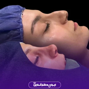 نمونه کار عمل بینی دکتر لاله ترابی 9