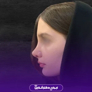 نمونه کار عمل بینی دکتر لاله ترابی 8