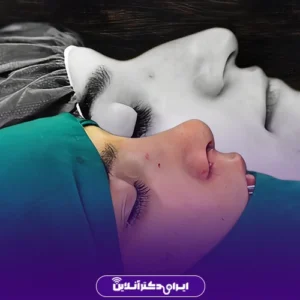 نمونه کار عمل بینی دکتر لاله ترابی 7