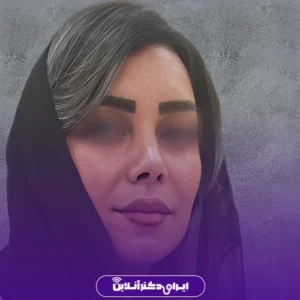 نمونه کار عمل بینی دکتر لاله ترابی 4