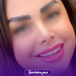 نمونه کار عمل بینی دکتر لاله ترابی 1