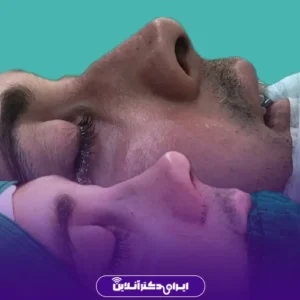 نمونه کار عمل بینی دکتر لاله ترابی 10